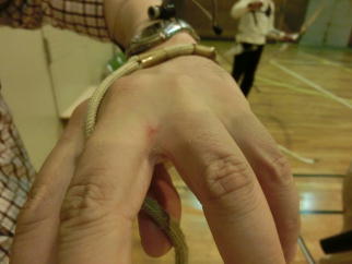 �_�j�ɂ�鏝���ƁB�����ǂɂ����ӁI